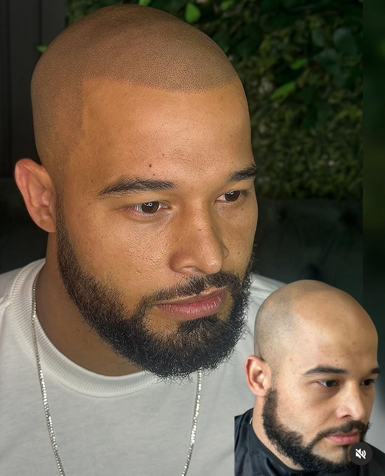 Efeito cabelo raspado completo